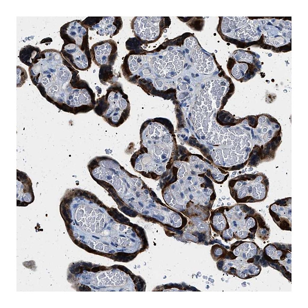 Atlas Antibodies Anti-PHRF1 Antibody