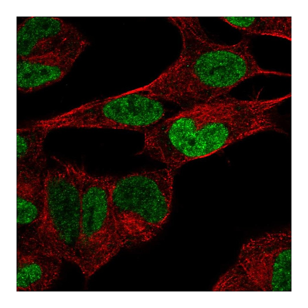 Atlas Antibodies Anti-PHOX2B Antibody