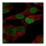 Atlas Antibodies Anti-PHOX2B Antibody