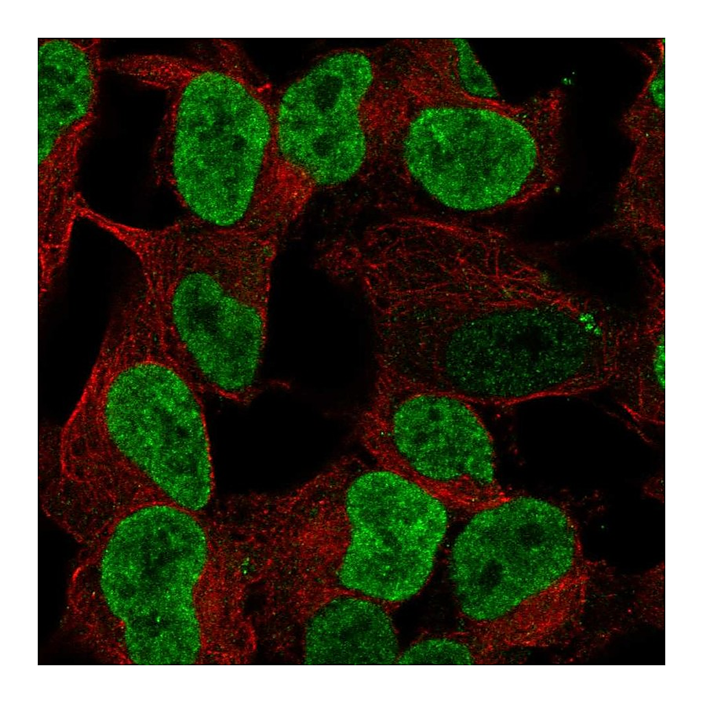 Atlas Antibodies Anti-PHOX2B Antibody