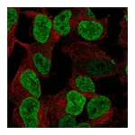Atlas Antibodies Anti-PHOX2B Antibody