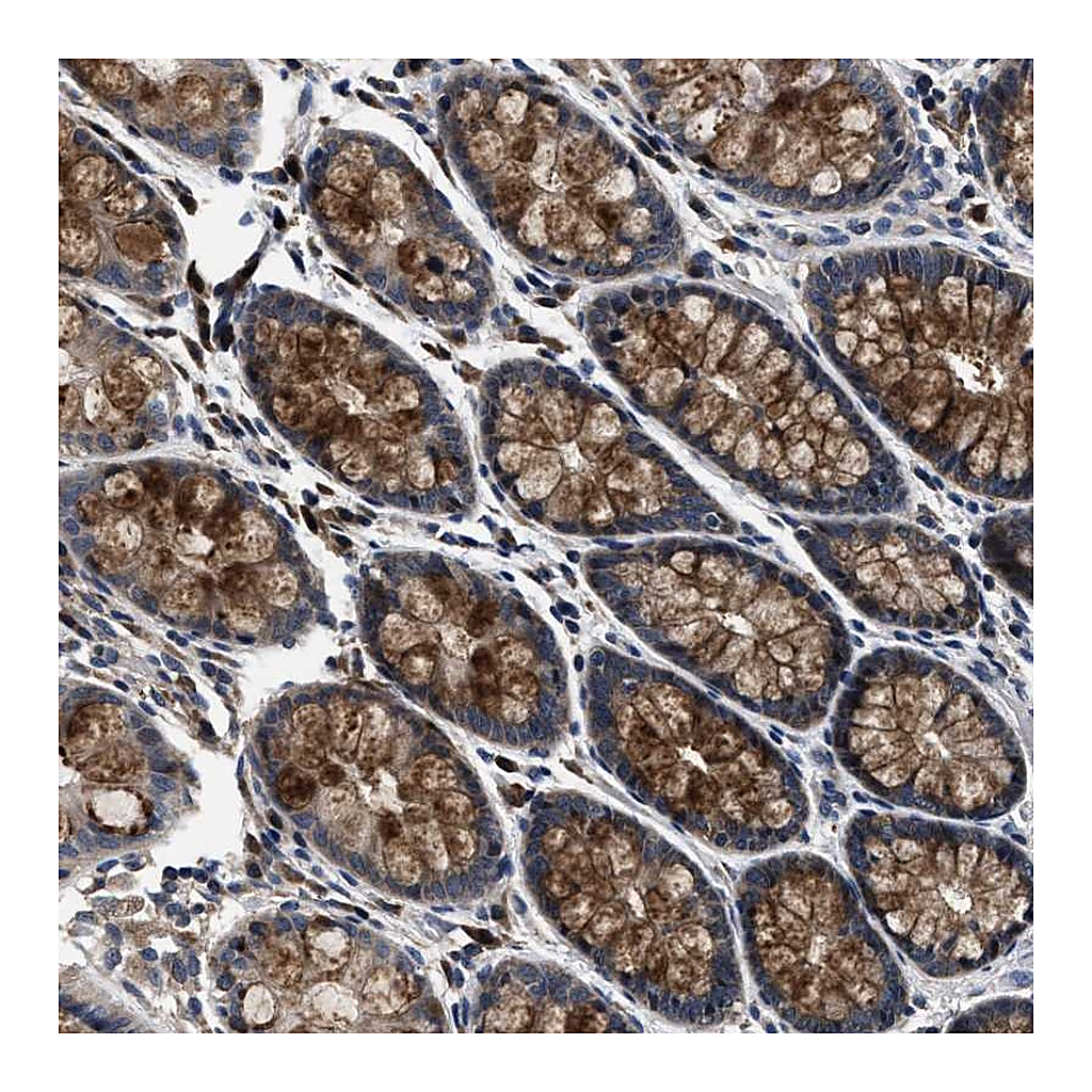 Atlas Antibodies Anti-PHPT1 Antibody