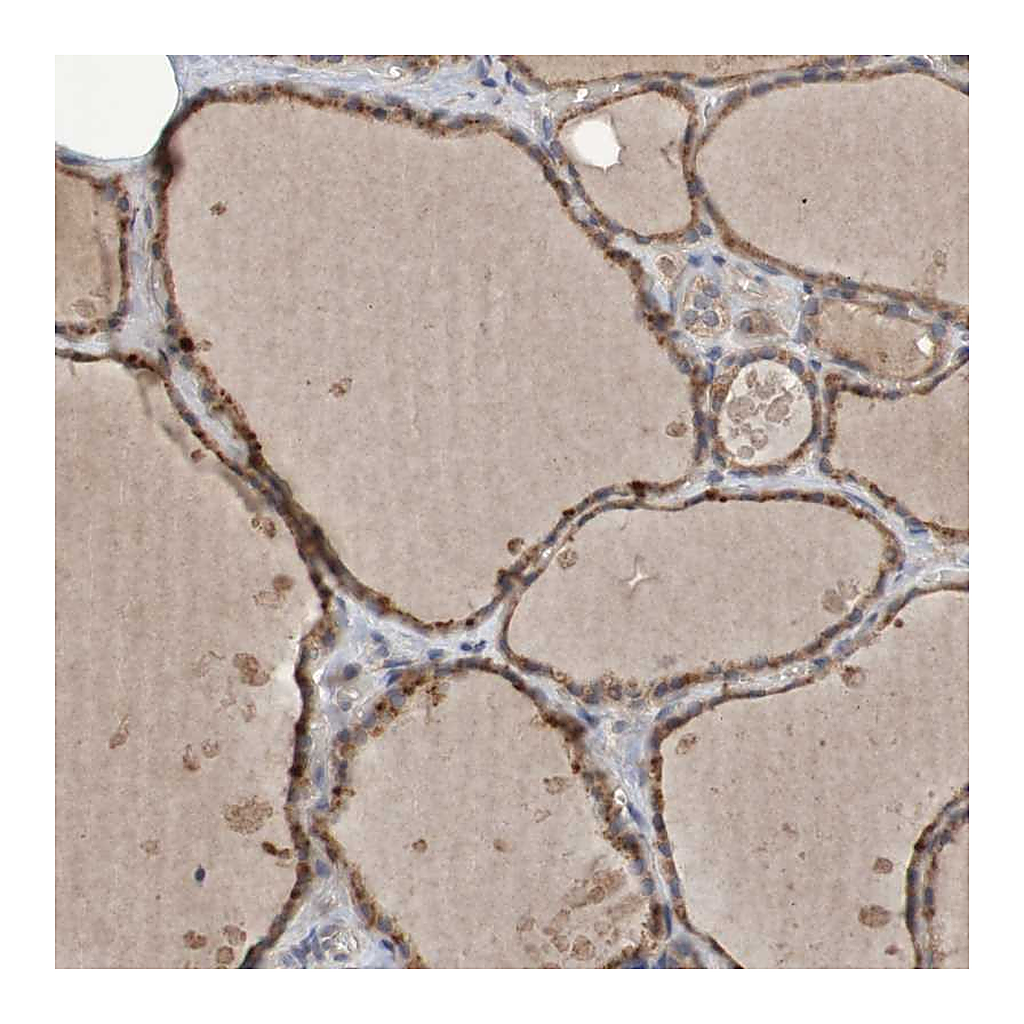 Atlas Antibodies Anti-PHYH Antibody
