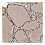 Atlas Antibodies Anti-PHYH Antibody
