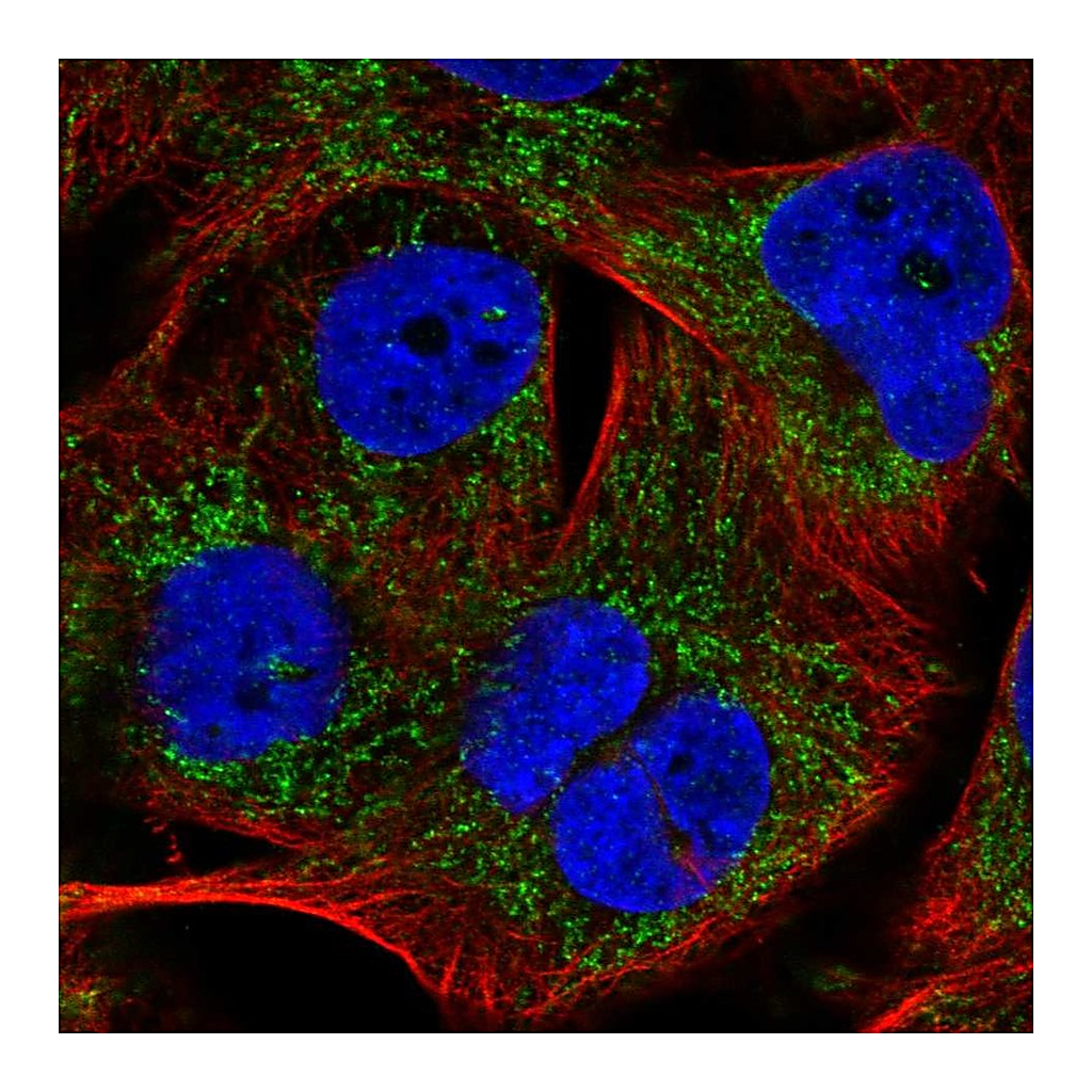 Atlas Antibodies Anti-PHYHIP Antibody