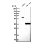 Atlas Antibodies Anti-PHYHD1 Antibody
