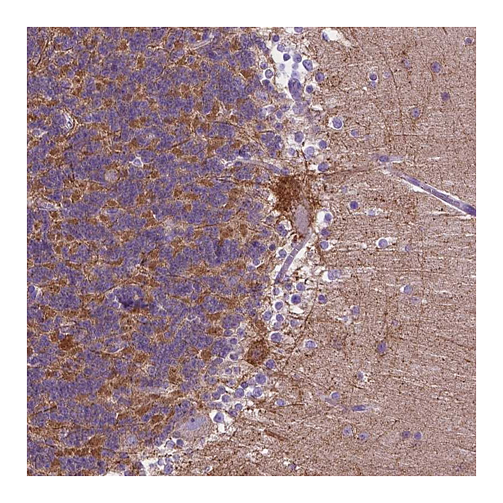 Atlas Antibodies Anti-PHYHIP Antibody