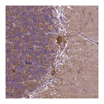 Atlas Antibodies Anti-PHYHIP Antibody