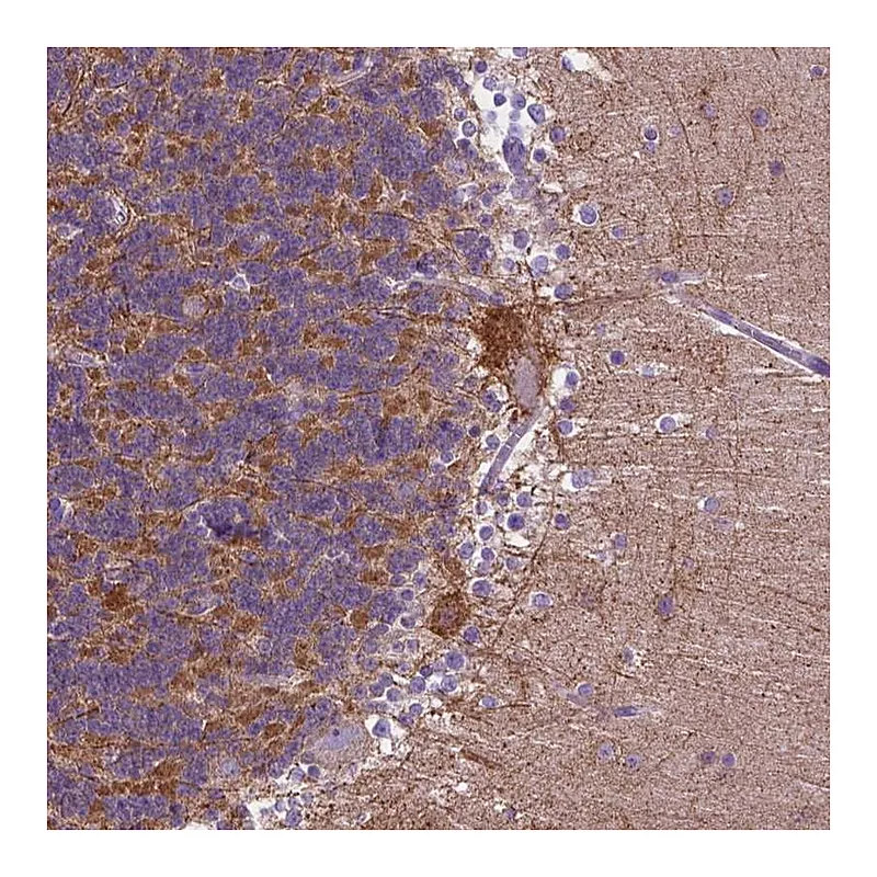 Atlas Antibodies Anti-PHYHIP Antibody