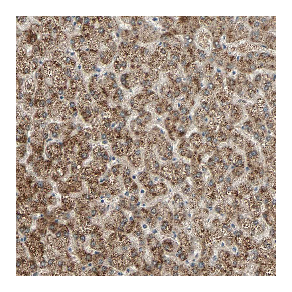 Atlas Antibodies Anti-PHYH Antibody