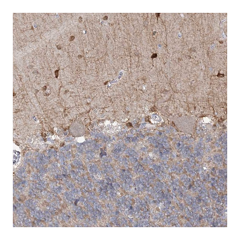 Atlas Antibodies Anti-PHYHIPL Antibody