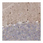Atlas Antibodies Anti-PHYHIPL Antibody