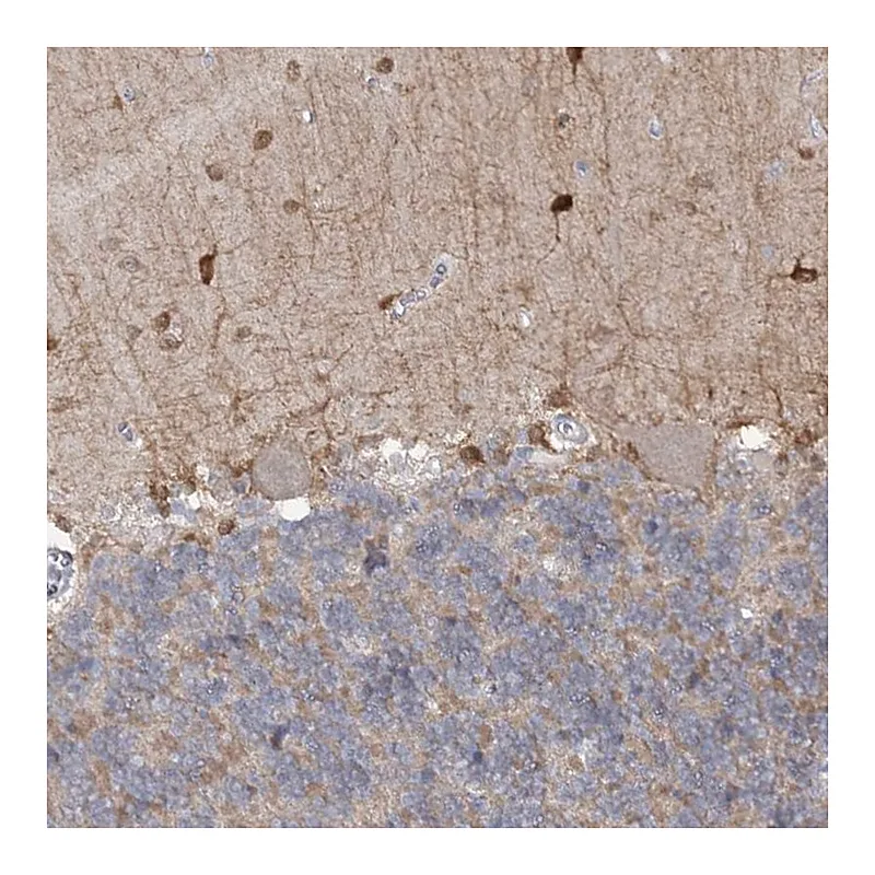 Atlas Antibodies Anti-PHYHIPL Antibody