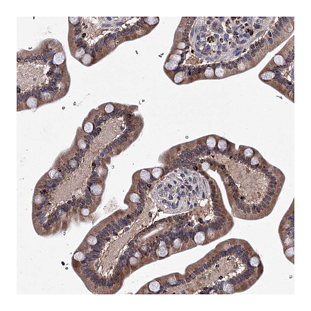 Atlas Antibodies Anti-PHYKPL Antibody