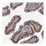 Atlas Antibodies Anti-PHYKPL Antibody