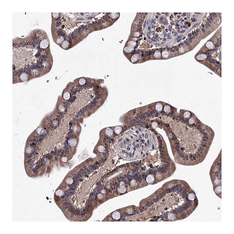 Atlas Antibodies Anti-PHYKPL Antibody