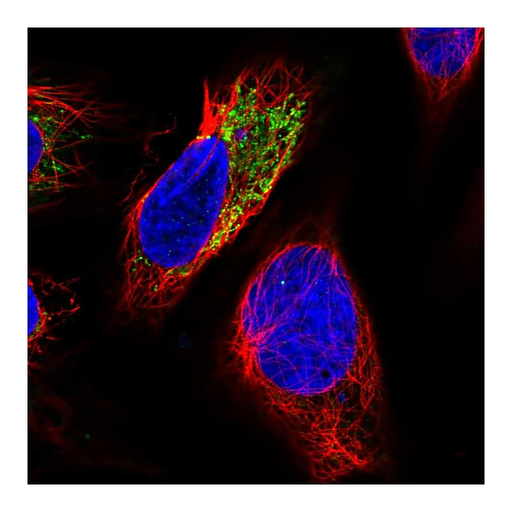 Atlas Antibodies Anti-PHYKPL Antibody