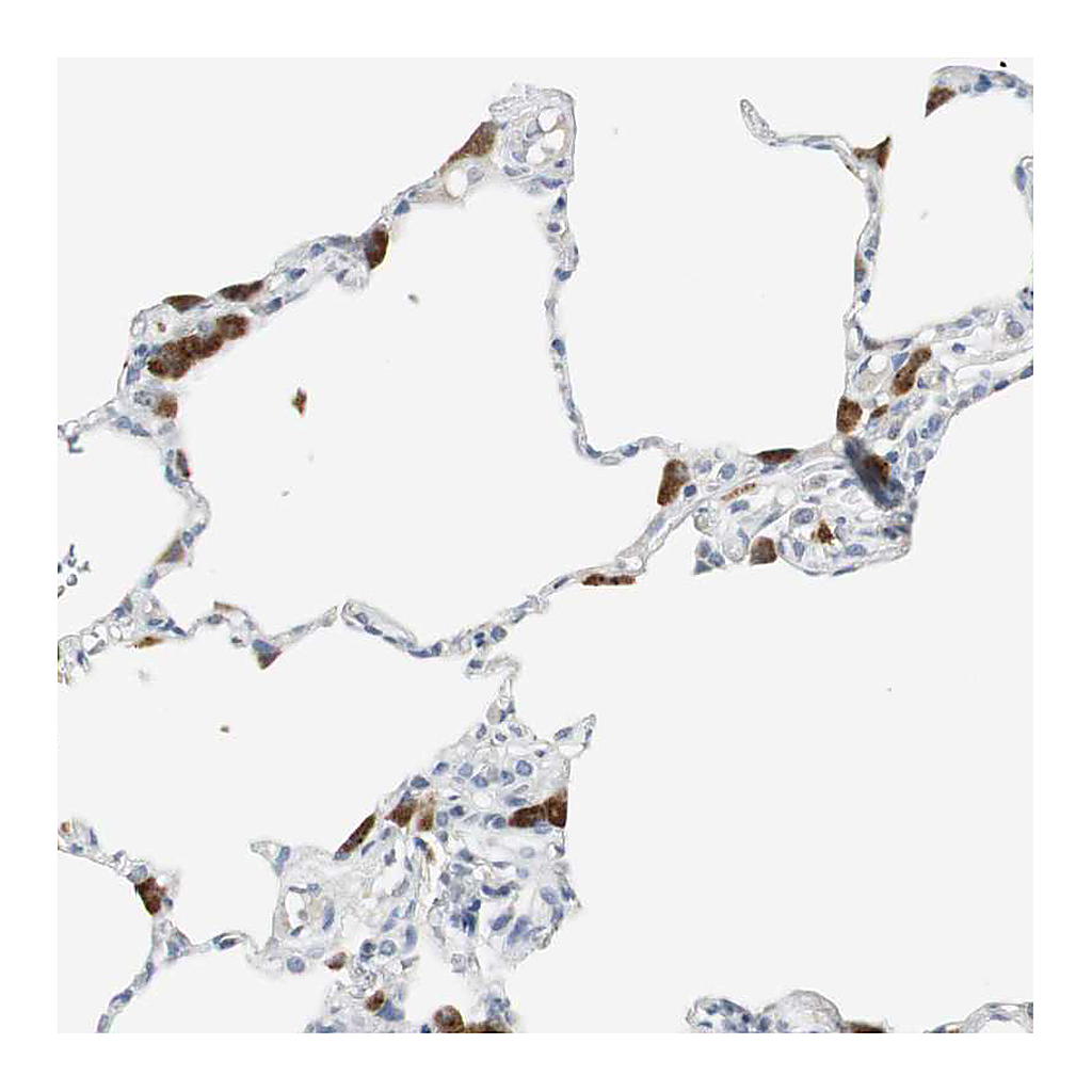 Atlas Antibodies Anti-PI15 Antibody