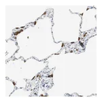 Atlas Antibodies Anti-PI15 Antibody