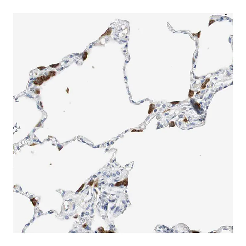 Atlas Antibodies Anti-PI15 Antibody