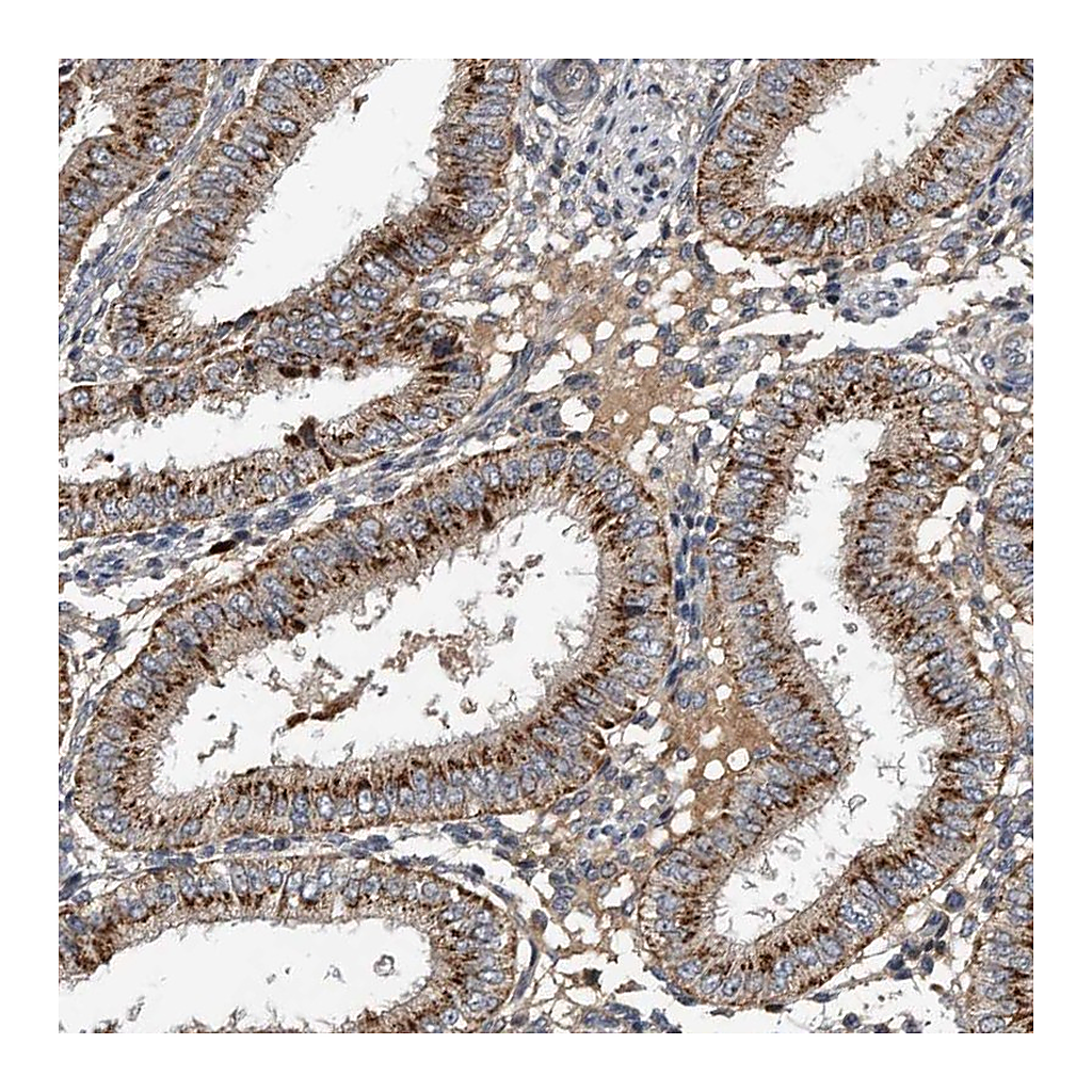 Atlas Antibodies Anti-PI15 Antibody
