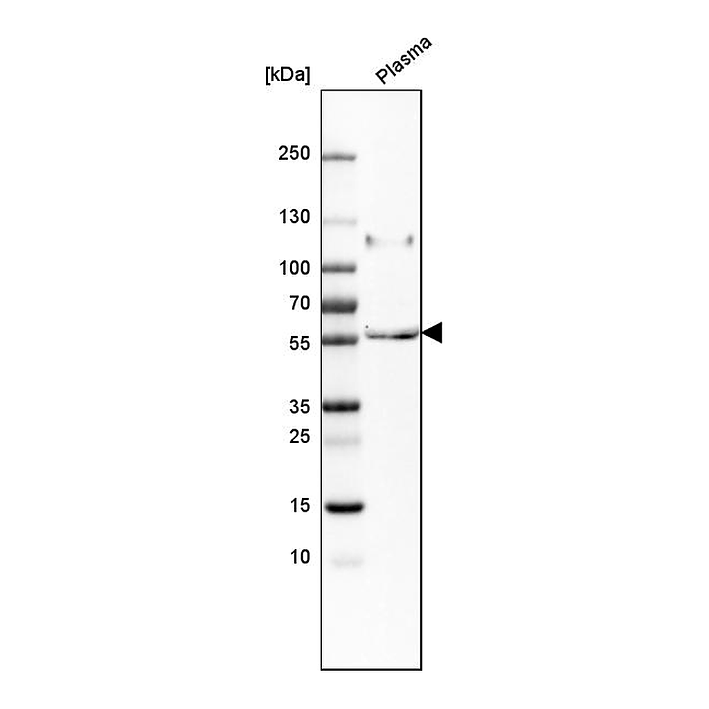 Atlas Antibodies Anti-PI16 Antibody