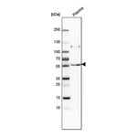 Atlas Antibodies Anti-PI16 Antibody