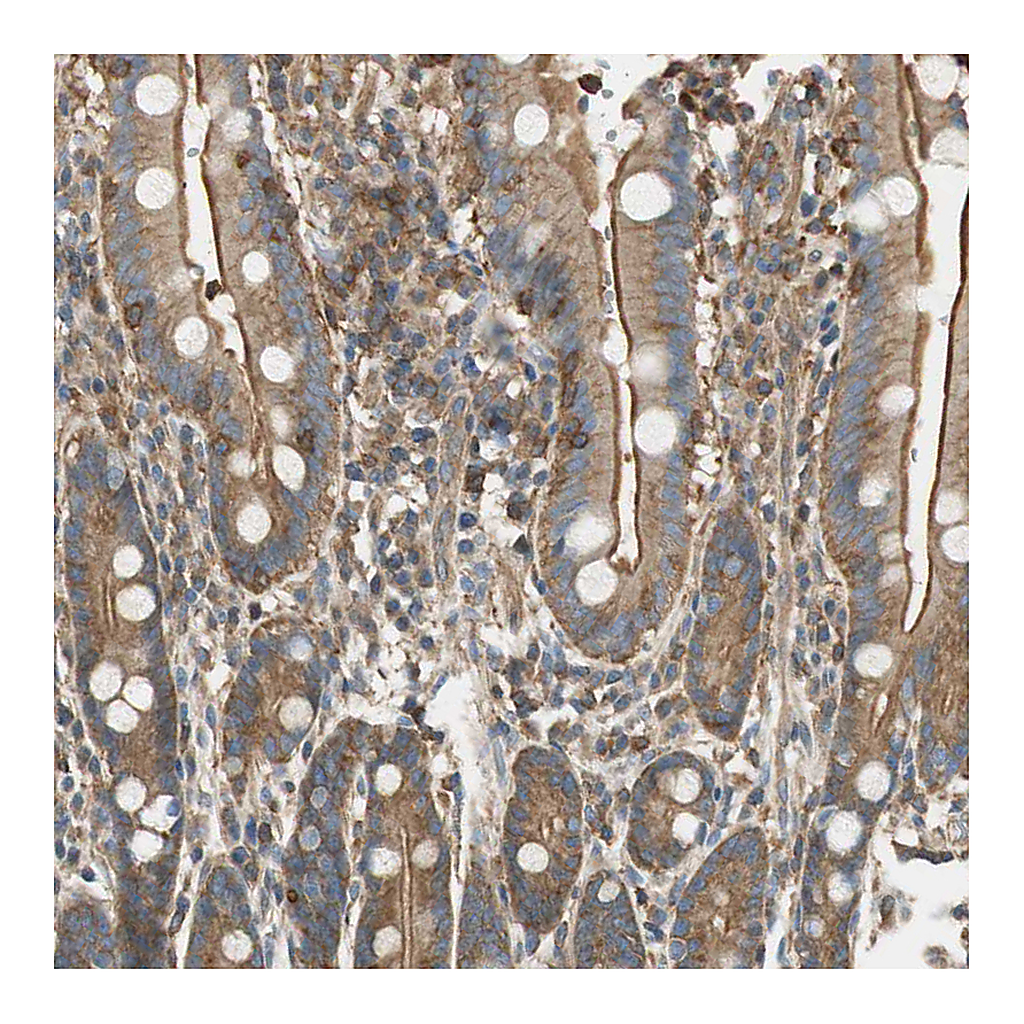 Atlas Antibodies Anti-PI4K2B Antibody