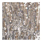 Atlas Antibodies Anti-PI4K2B Antibody