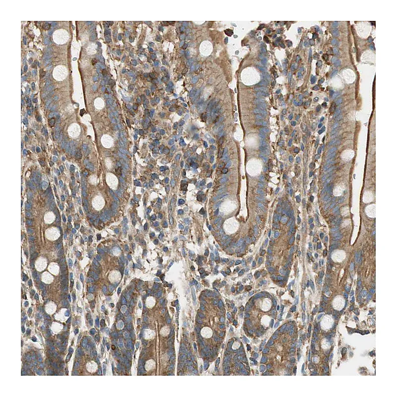 Atlas Antibodies Anti-PI4K2B Antibody