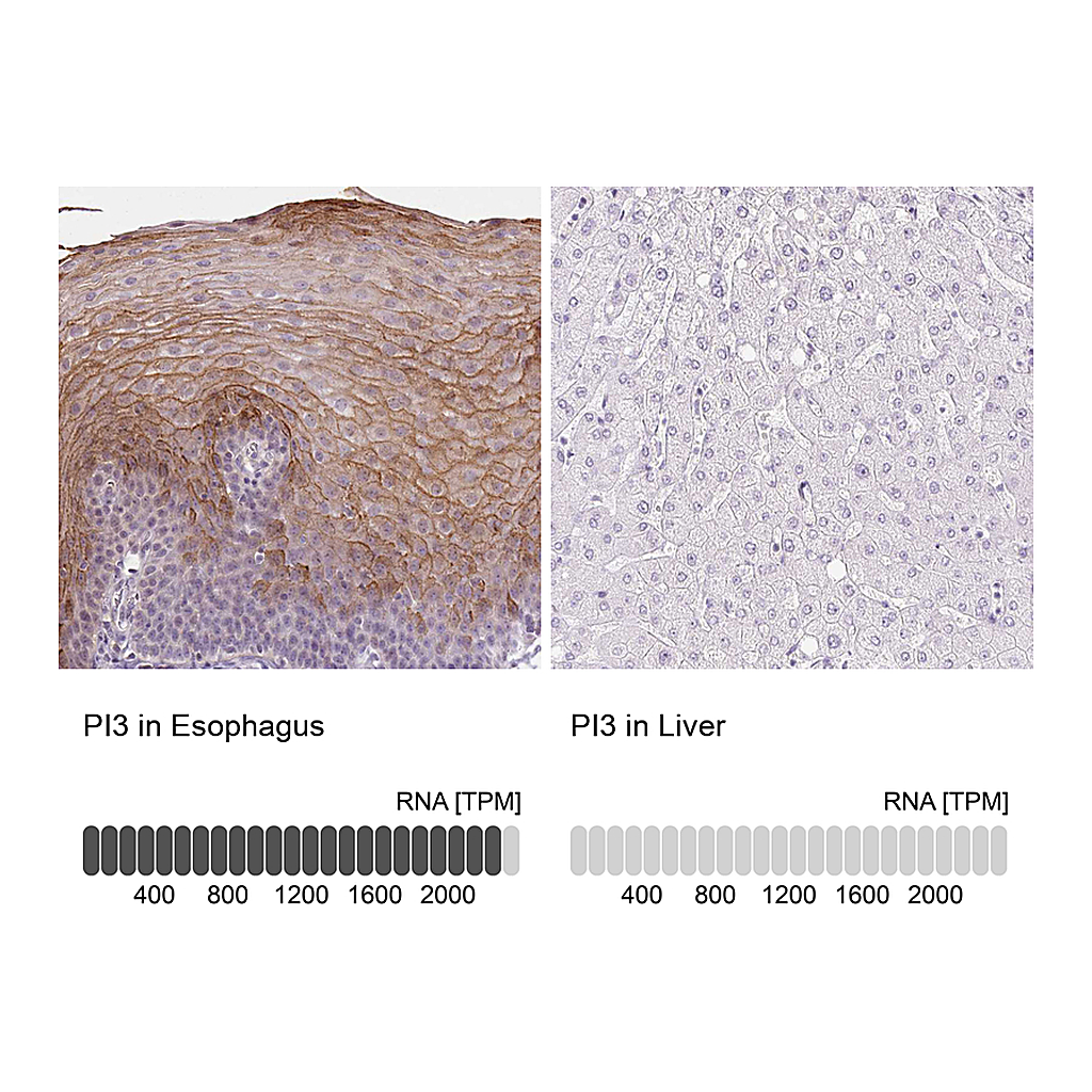 Atlas Antibodies Anti-PI3 Antibody