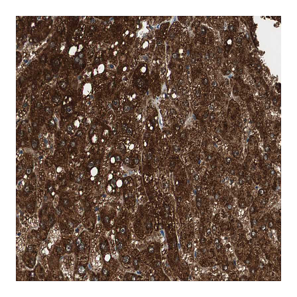 Atlas Antibodies Anti-PI4KB Antibody