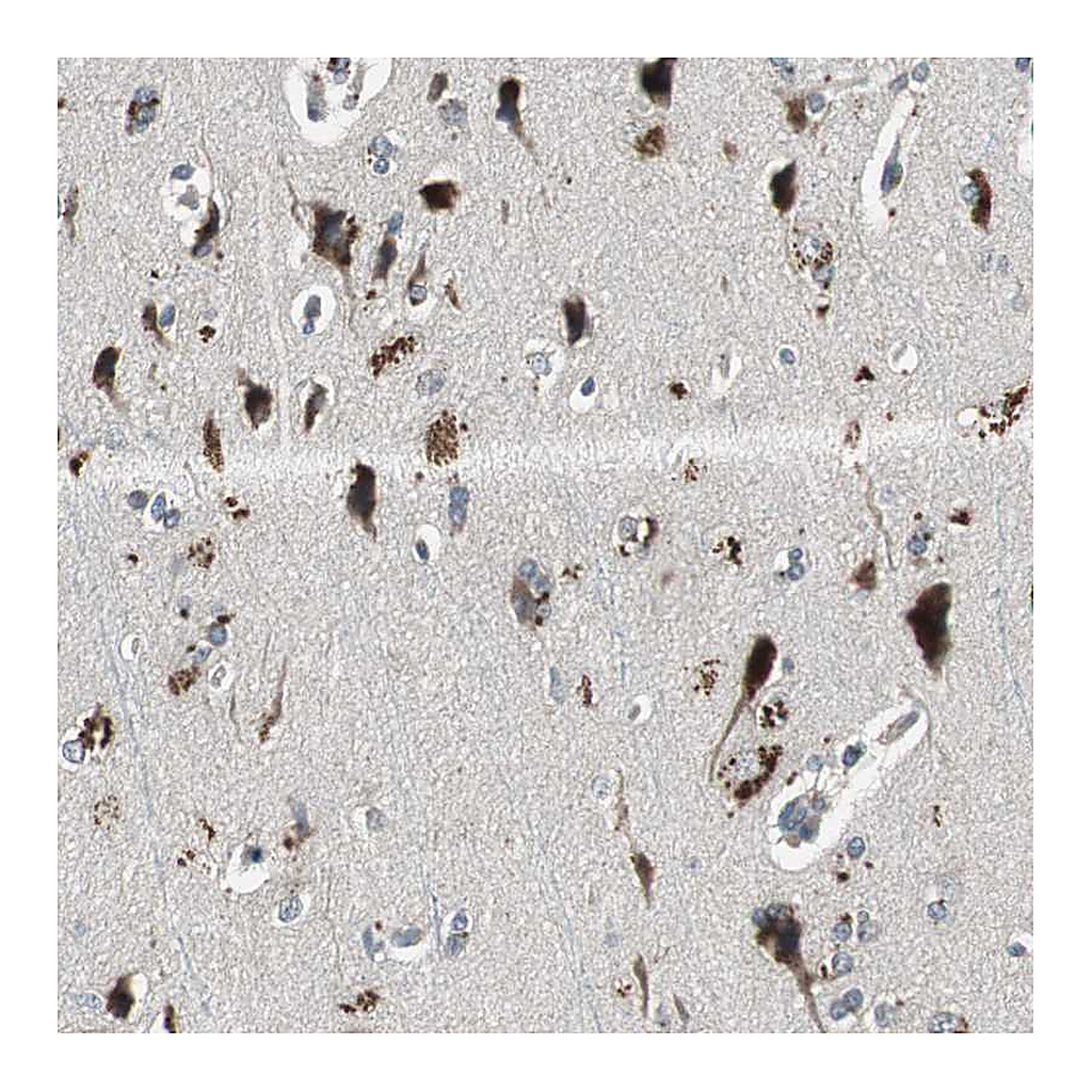 Atlas Antibodies Anti-PI4KB Antibody
