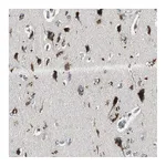 Atlas Antibodies Anti-PI4KB Antibody