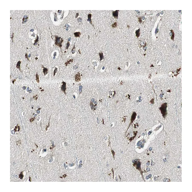 Atlas Antibodies Anti-PI4KB Antibody
