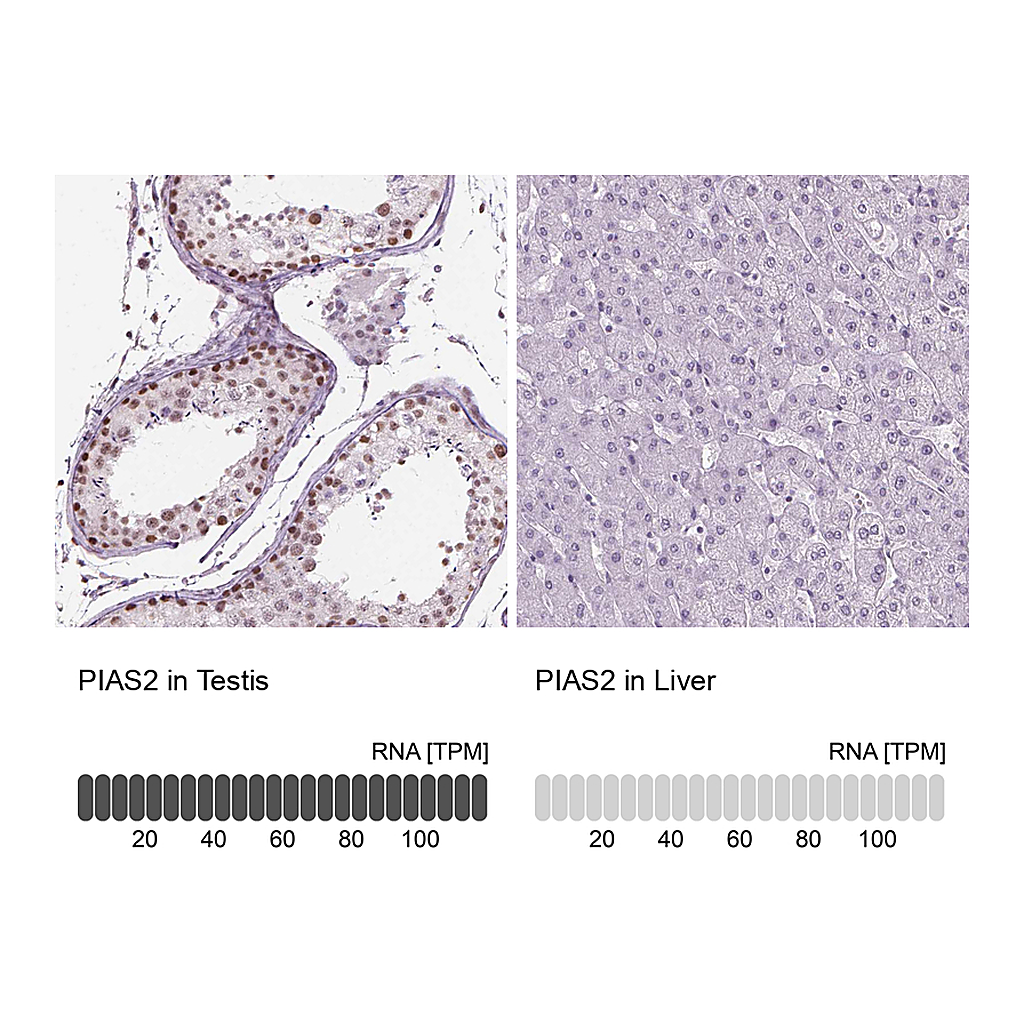Atlas Antibodies Anti-PIAS2 Antibody