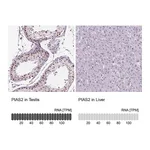 Atlas Antibodies Anti-PIAS2 Antibody