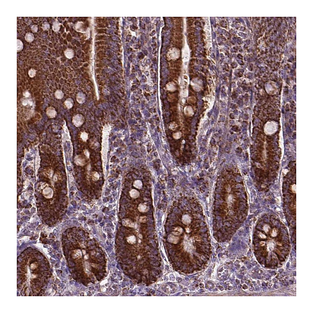 Atlas Antibodies Anti-PIBF1 Antibody