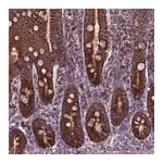 Atlas Antibodies Anti-PIBF1 Antibody