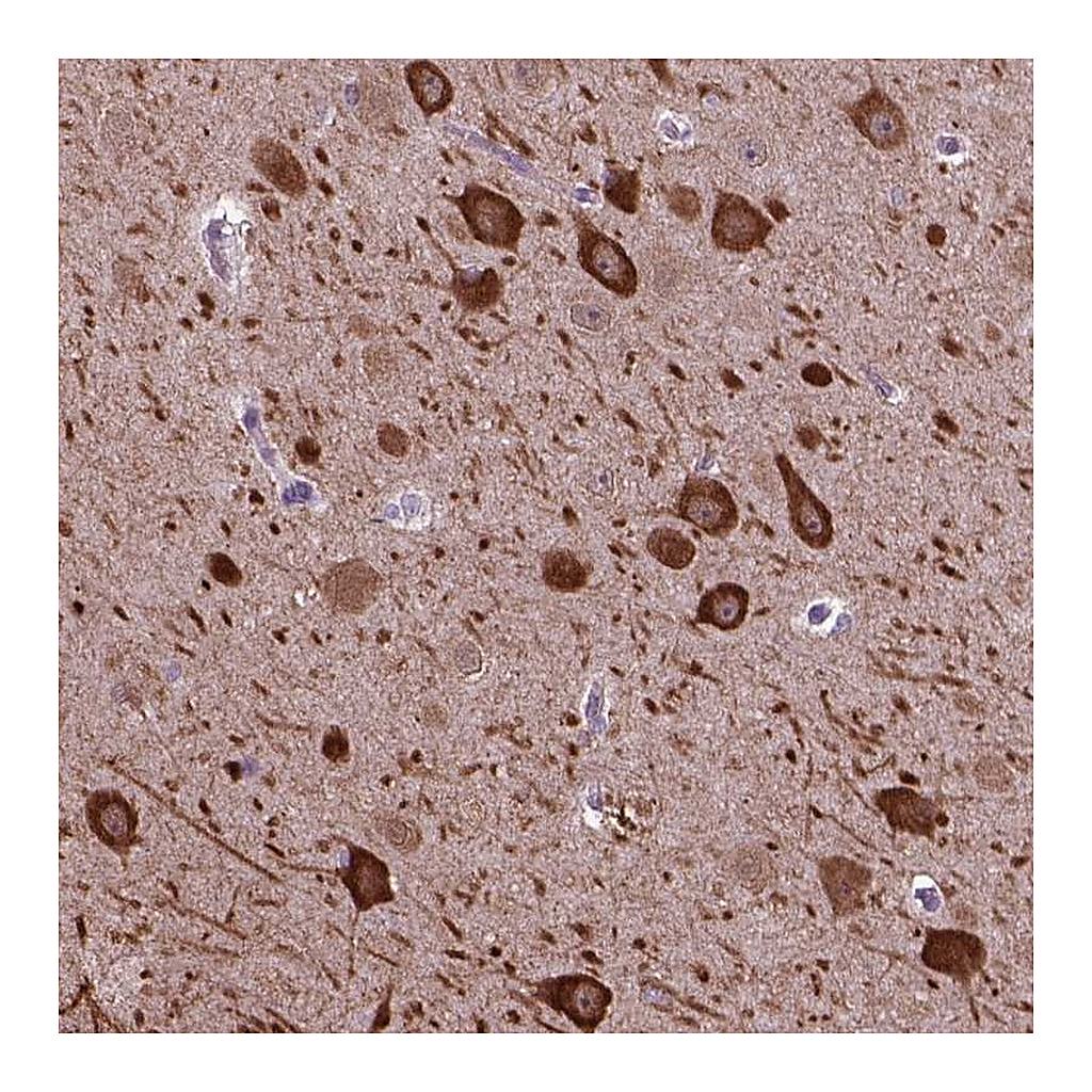 Atlas Antibodies Anti-PIAS3 Antibody