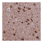 Atlas Antibodies Anti-PIAS3 Antibody