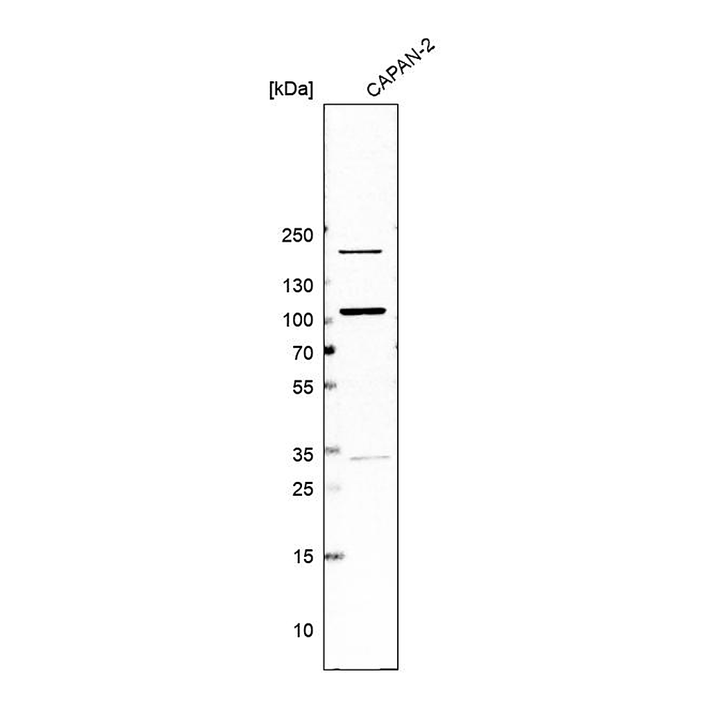 Atlas Antibodies Anti-PIBF1 Antibody