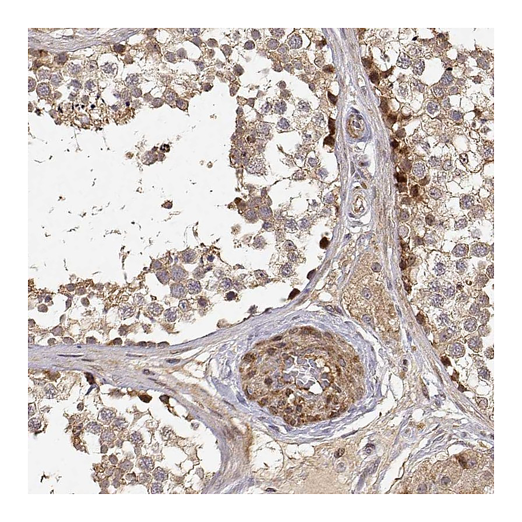 Atlas Antibodies Anti-PICK1 Antibody