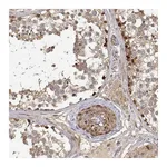 Atlas Antibodies Anti-PICK1 Antibody