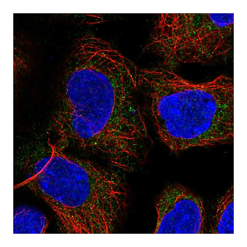 Atlas Antibodies Anti-PICK1 Antibody