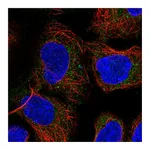 Atlas Antibodies Anti-PICK1 Antibody
