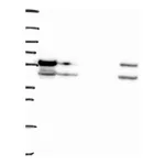 Atlas Antibodies Anti-PIAS4 Antibody