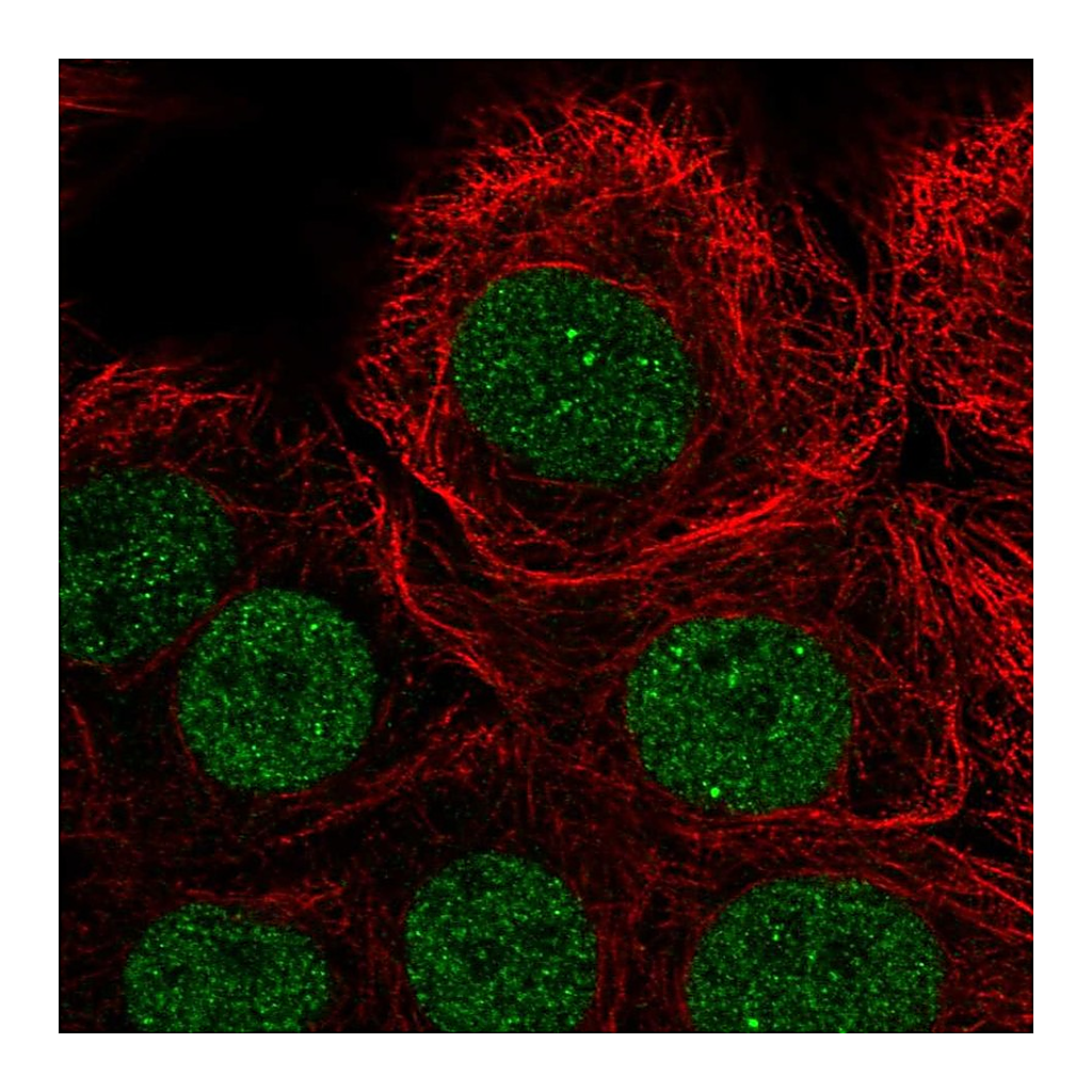 Atlas Antibodies Anti-PIAS3 Antibody