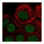 Atlas Antibodies Anti-PIAS3 Antibody