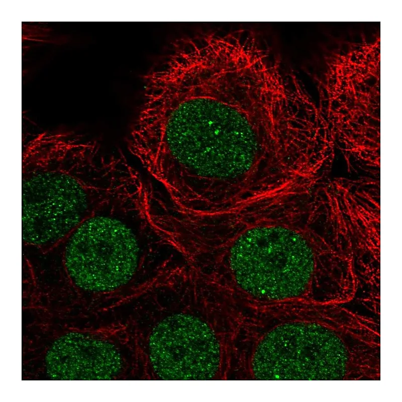 Atlas Antibodies Anti-PIAS3 Antibody